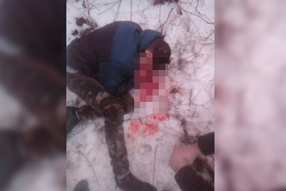 Две недели назад 15-летнего школьника жестоко избили за камуфляжные штаны. Фото: СОЦСЕТИ