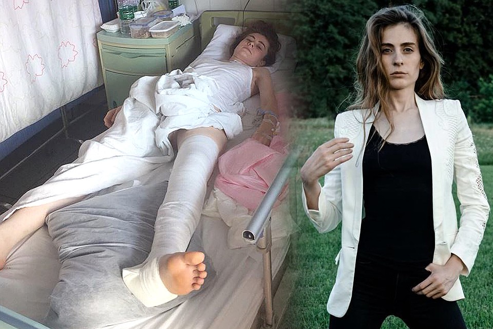 Модель Татьяна Трибель неудачно прокатилась на скутере и серьезно повредила позвоночник.