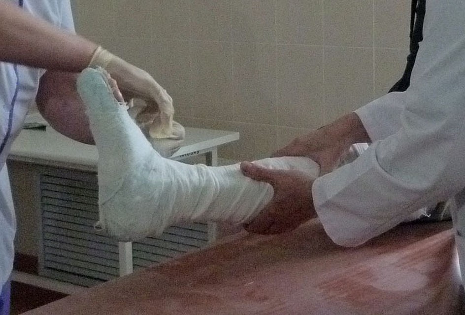 Тюменцам рассказали, как оказать первую помощь при растяжениях, ушибах и переломах