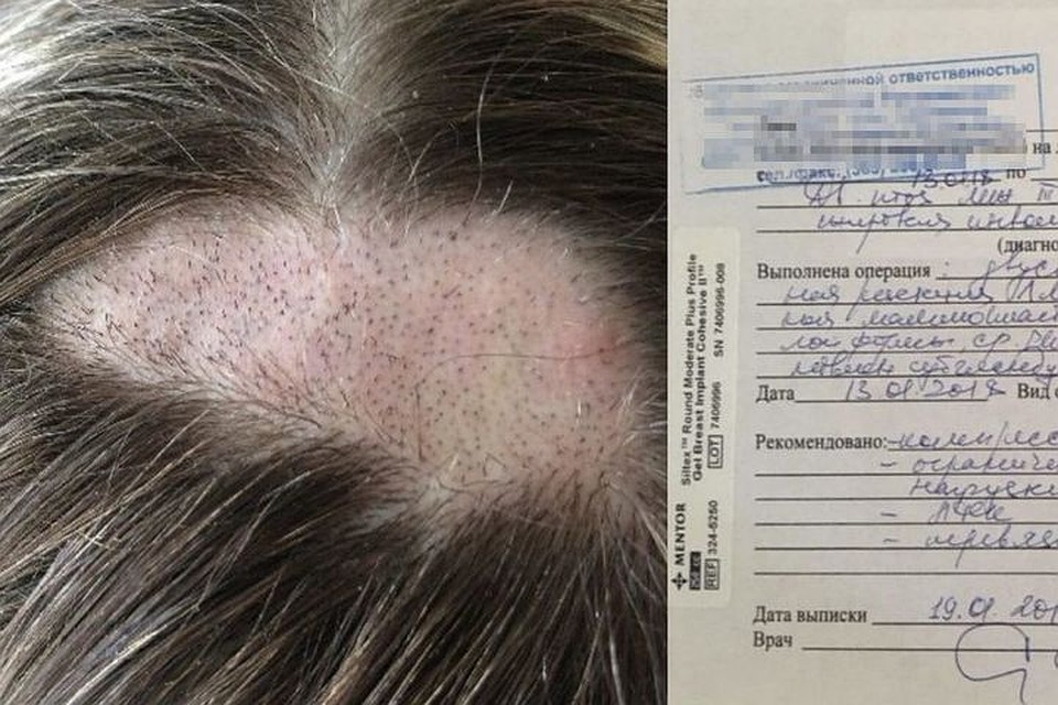 За неудачную операцию девушка заплатила 320 тысяч рублей. Фото: https://novosibirsk.flamp.ru/