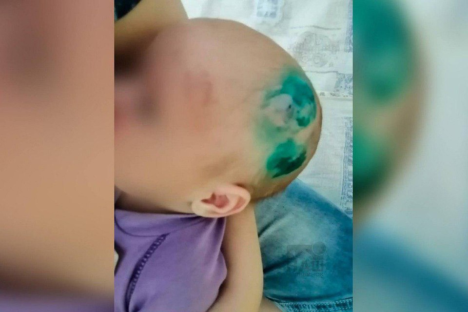 По данным СК, ребенок попал в больницу после того, как мать его уронила. Фото: соцсети.
