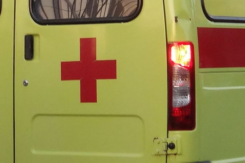 На Ямале собака, сорвавшаяся с цепи, укусила девочку за лицо