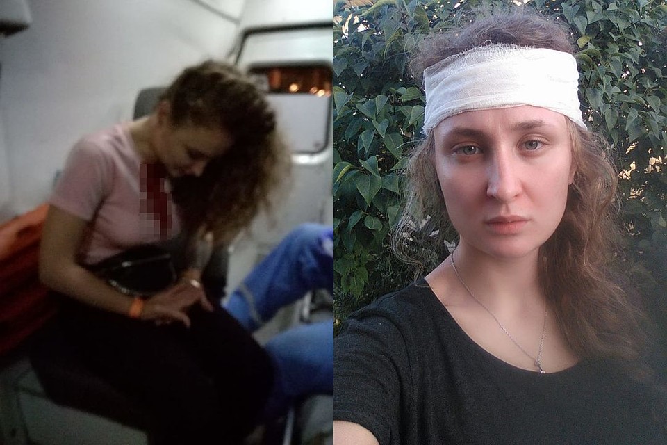 Парень попал стеклянной бутылкой в голову девушке, когда та ждала такси у бара. Фото: личный архив.