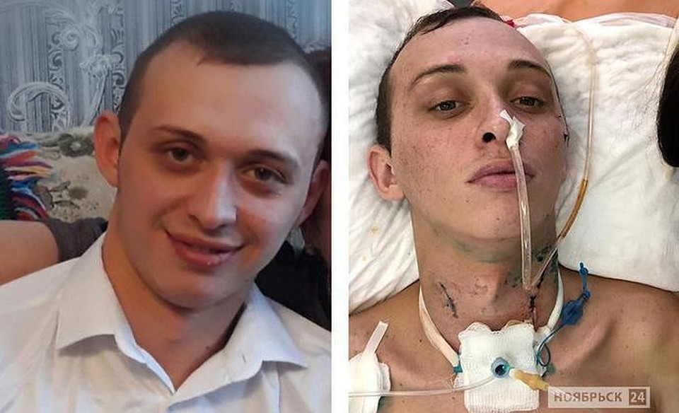 В Москве скончался парень, попавший в ДТП под Тюменью. Фото - "Ноябрьск 24".