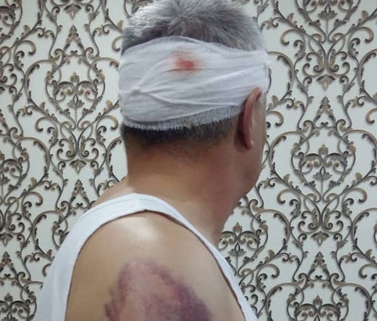 Нападавшие жестоко избили директора госпредприятия «Кыргызкомур».