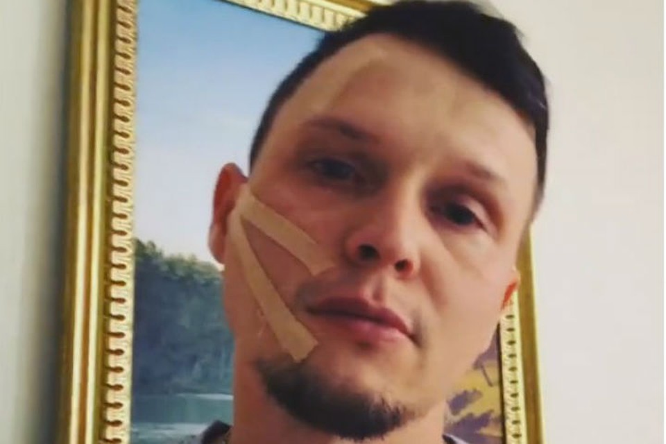 Что за болезнь поразила иркутского рэпера: Анатолий Заммер записал видеообращение поклонникам. Фото: скриншот с видео