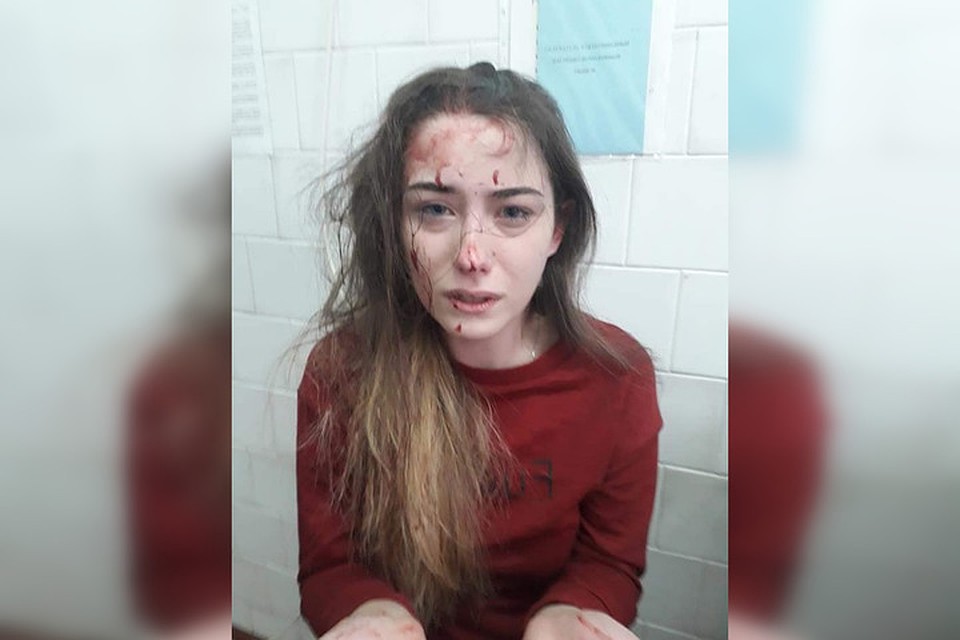 Очередной украинский фейк. Днепропетровскую школьницу, избитую одноклассницами почти год назад, в соцсетях выдали за жертву Народной дружины в Горловке. Фото: obozrevatel.com
