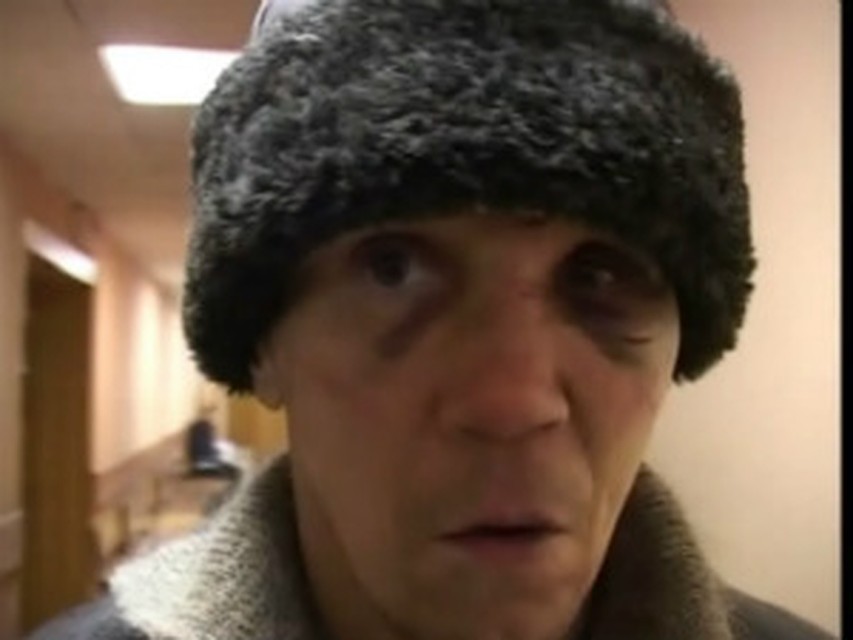 Свербаева доставили в суд с синяками.