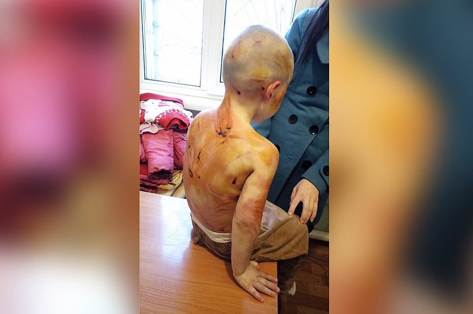 Отчим-гастарбайтер жестоко избил 4-летнюю девочку. Фото: пресс-служба СК России по Красноярскому краю