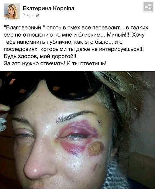 Следы избиения Екатерины Архаровой.