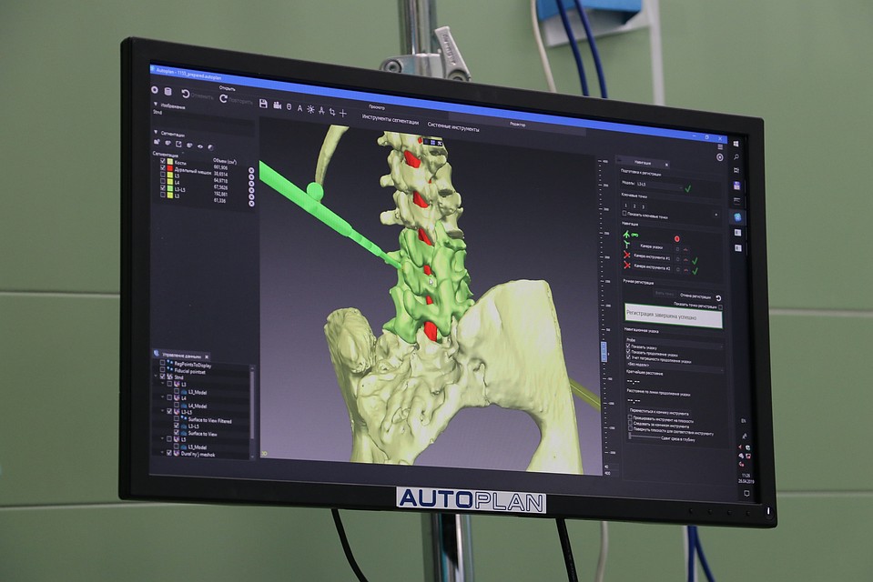 На основе полученной 3D-модели хирург планирует будущую операцию. Фото: СамГМУ