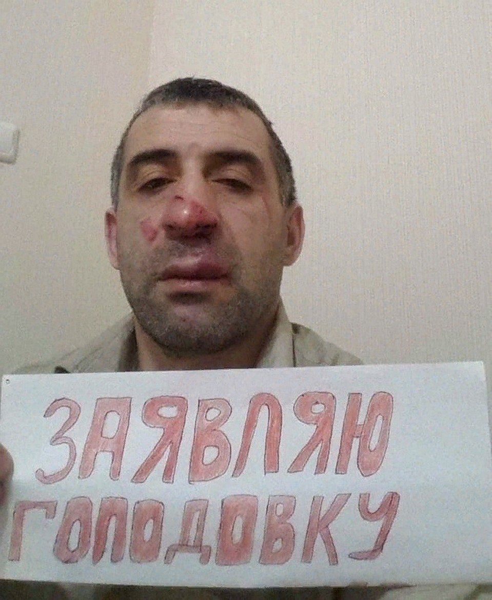 Побитый приставами (по словам мужчины) Муса объявил голодовку. Фото: соцсети