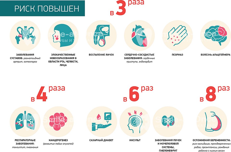 Инфографика наглядно демонстрирует, к каким последствиям может привести пародонтит, если не заниматься его лечением.