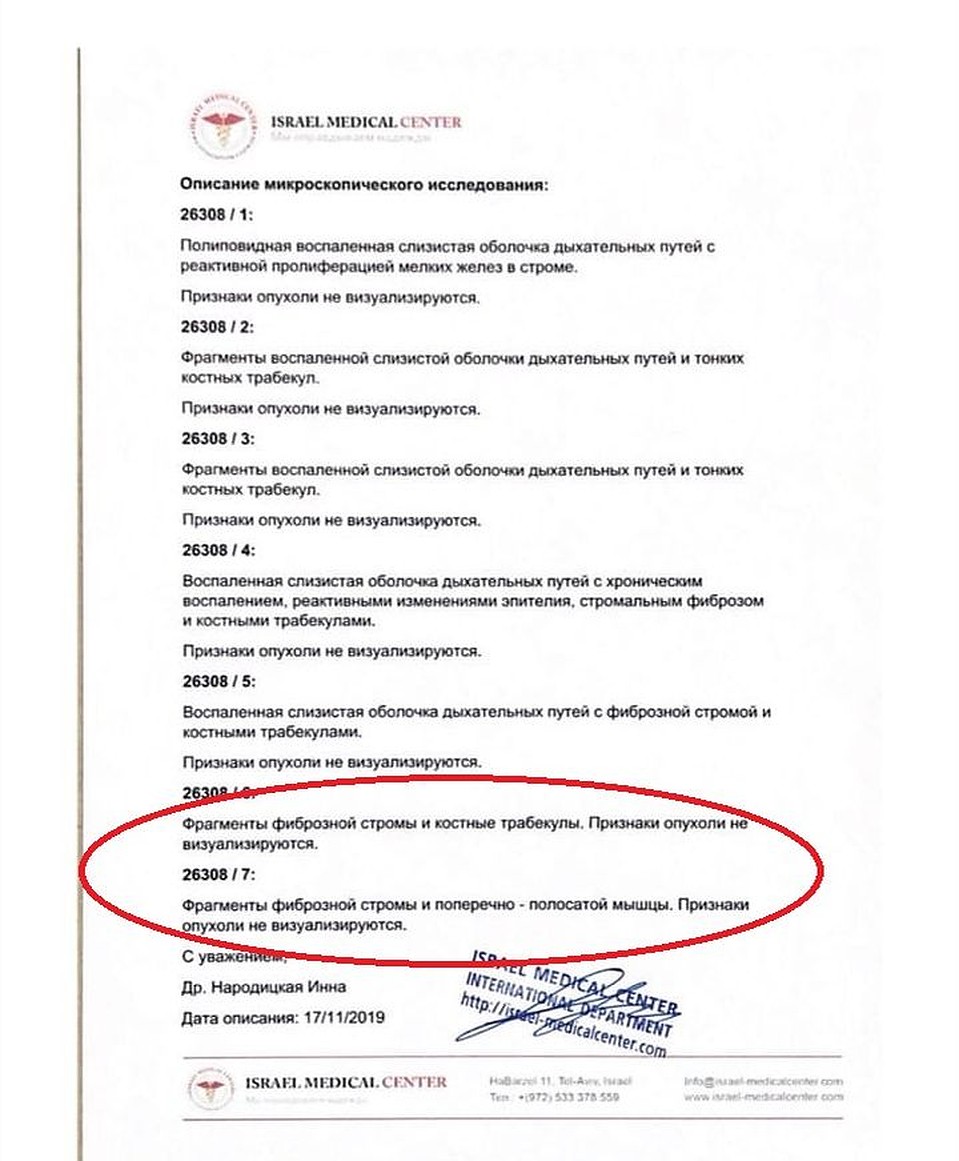Исследования ткани опухоли после ее удаления. Фото: личный архив.