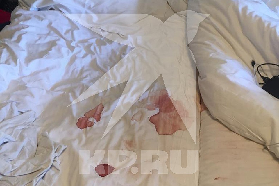 Следы крови повсюду в номере.