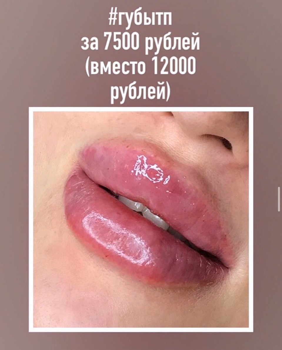 Горячие "антикоронавирусные" акции. Фото: Личная страница героя публикации в соцсети