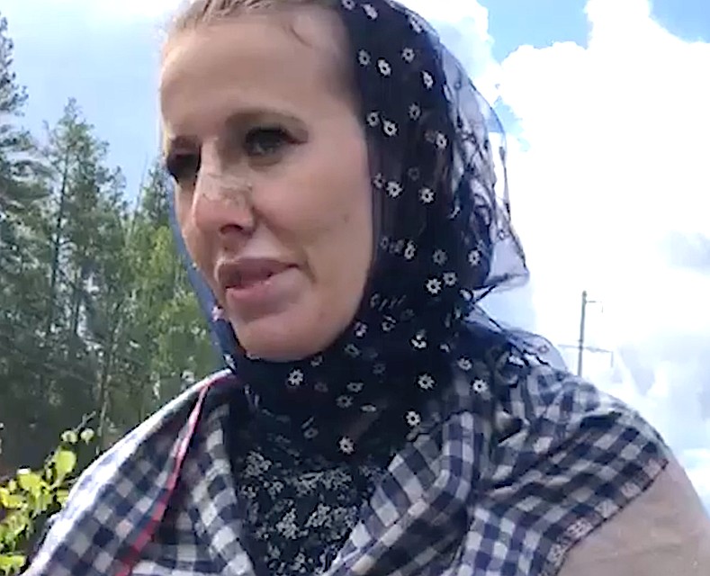 Накладывать гипс, как это обычно бывает при переломе, ей не стали. Фото: кадр видео.