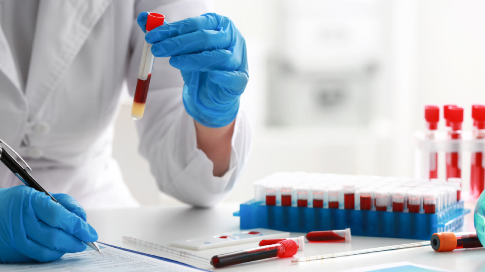 Мочевая кислота в крови