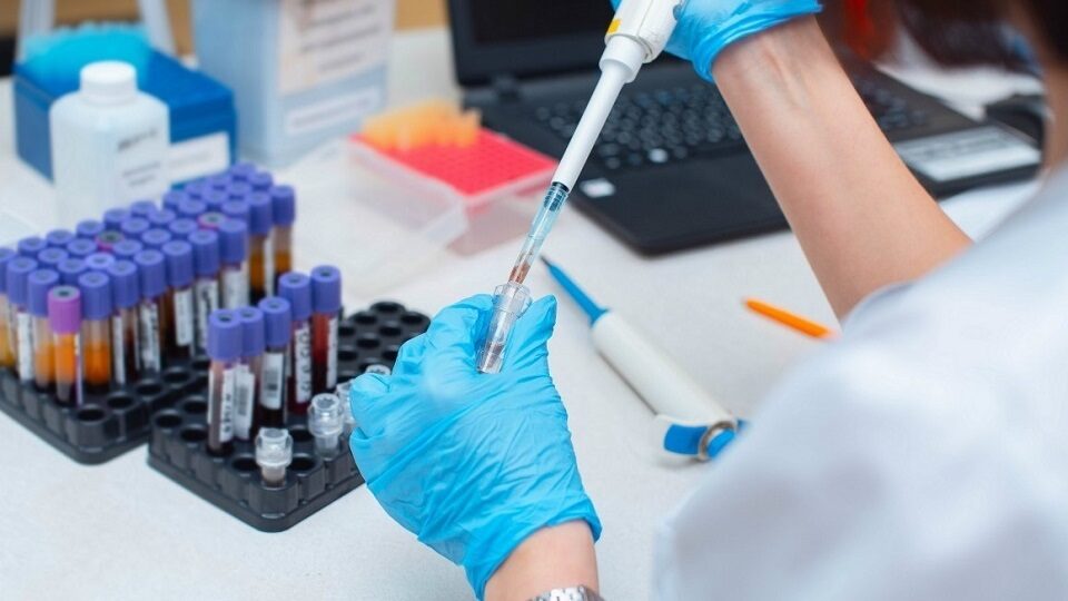 Вирусный гепатит В у взрослых