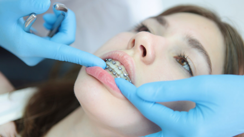 Больно ли ставить брекеты взрослым