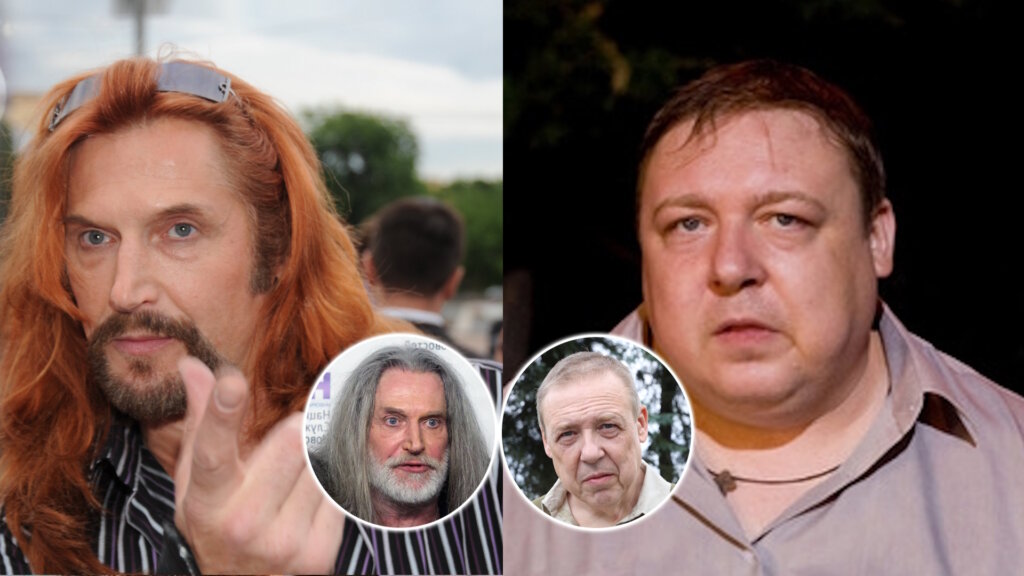 10 русских актеров, которые посещали косметологов и пластических хирургов